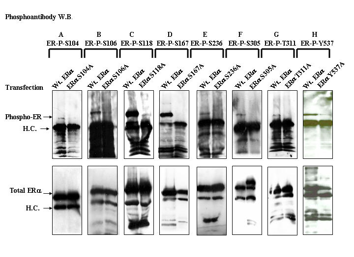 Application of phosphorylation site-specific antibodies to measure nuclear receptor signaling: characterization of novel phosphoantibodies for estrogen receptor alpha.