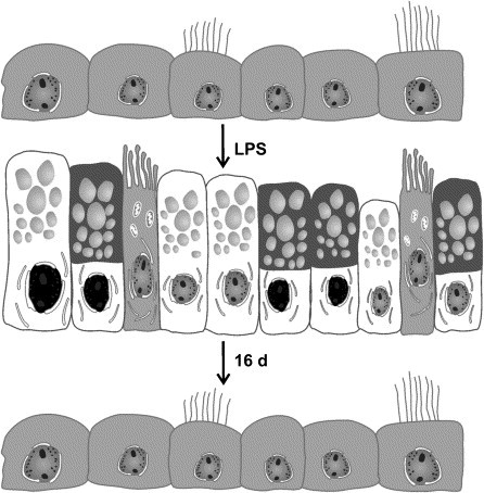 Exacerbations of chronic obstructive pulmonary disease and chronic mucus hypersecretion