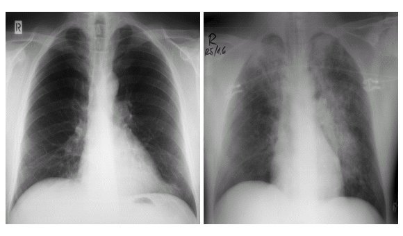 Perioperative risks and their management in patients with sleep-related breathing disorders.