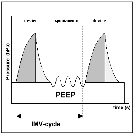 Selective indication for positive airway pressure (PAP) in sleep-related breathing disorders with obstruction.