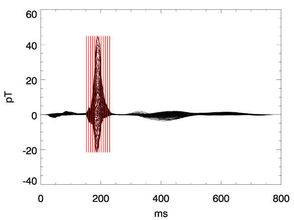 Pseudo current density maps of electrophysiological heart, nerve or brain function and their physical basis.