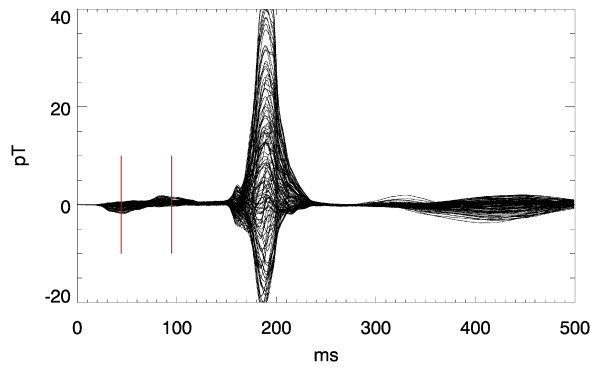 Pseudo current density maps of electrophysiological heart, nerve or brain function and their physical basis.