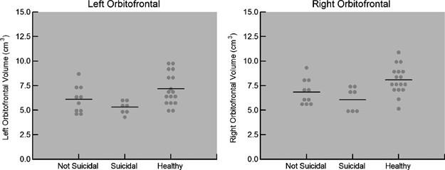 Fronto-limbic brain structures in suicidal and non-suicidal female patients with major depressive disorder