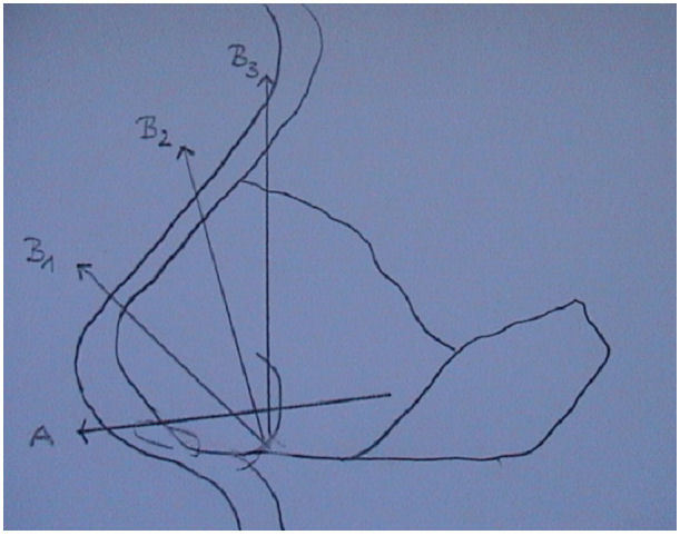 Surgery of the nasal septum and turbinates.