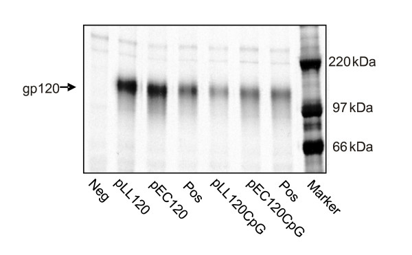 Immunological analysis of a Lactococcus lactis-based DNA vaccine expressing HIV gp120.