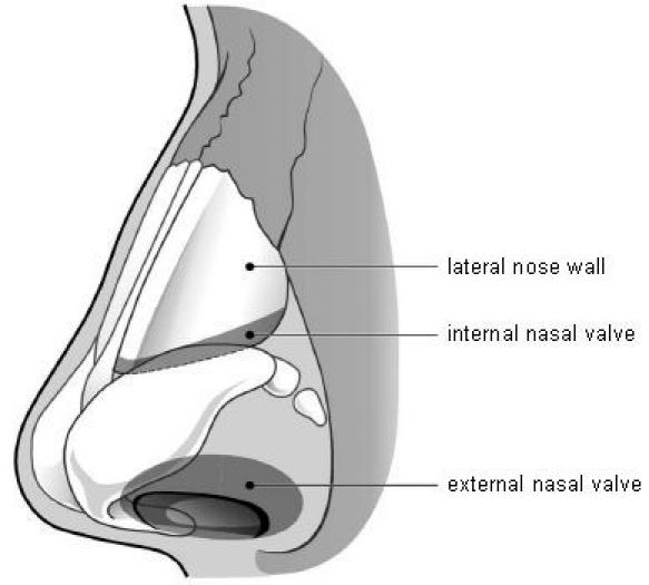 Disorders of the nasal valve area.