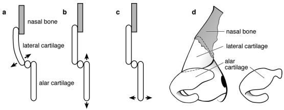 Disorders of the nasal valve area.
