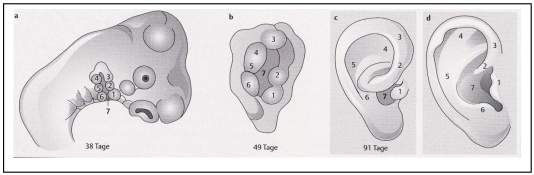 Classification and diagnosis of ear malformations.