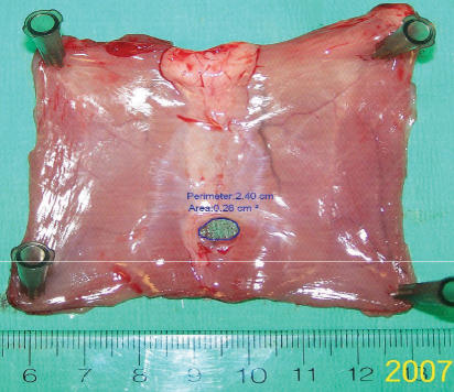 Amnion-derived multipotent progenitor cells increase gain of incisional breaking strength and decrease incidence and severity of acute wound failure.