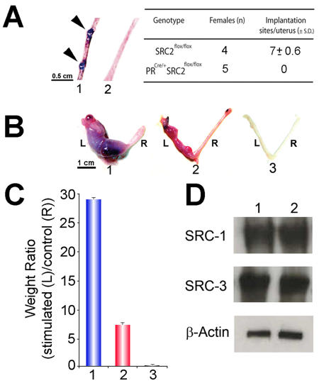 Steroid receptor coactivator 2 is required for female fertility and mammary morphogenesis: insights from the mouse, relevance to the human.