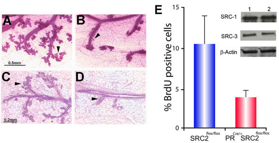 Steroid receptor coactivator 2 is required for female fertility and mammary morphogenesis: insights from the mouse, relevance to the human.