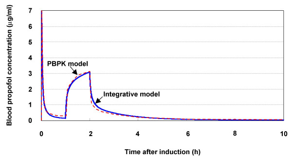 Simulation of propofol anaesthesia for intracranial decompression using brain hypothermia treatment.