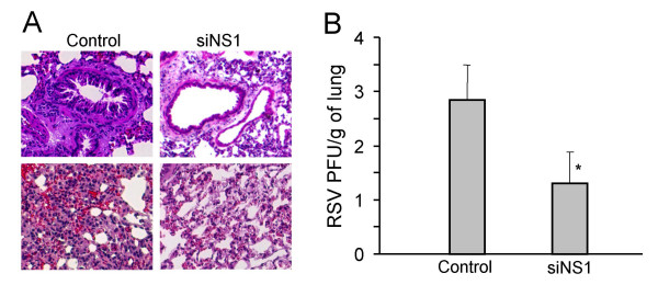 Respiratory syncytial virus infection in Fischer 344 rats is attenuated by short interfering RNA against the RSV-NS1 gene.