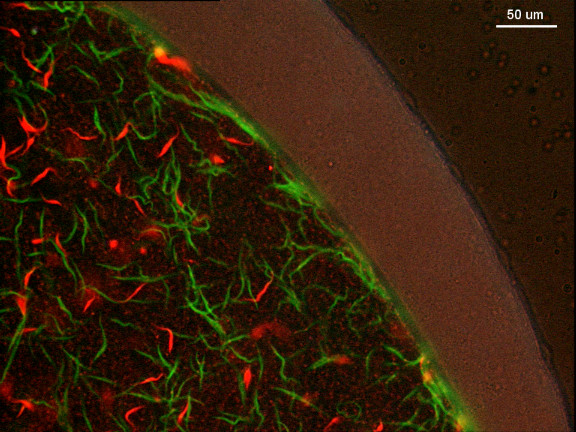 Dynamics of infection and competition between two strains of Trypanosoma brucei brucei in the tsetse fly observed using fluorescent markers.