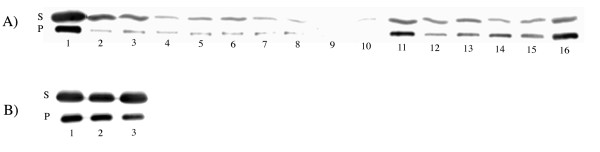 The effect of amino acid deletions and substitutions in the longest loop of GFP.