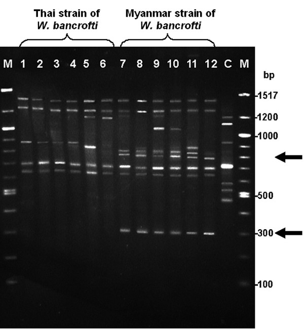 Random amplified polymorphic DNA (RAPD) for differentiation between Thai and Myanmar strains of Wuchereria bancrofti.