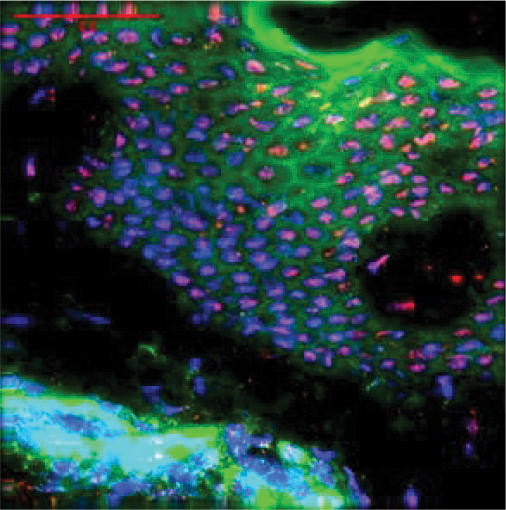 Nuclear localization of HBD-1 in human keratinocytes.