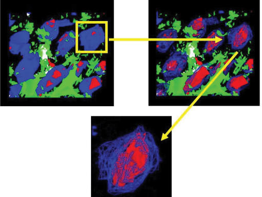 Nuclear localization of HBD-1 in human keratinocytes.