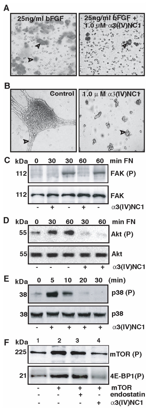 Molecular Cloning and Functional Characterization of Mouse α3(IV)NC1.