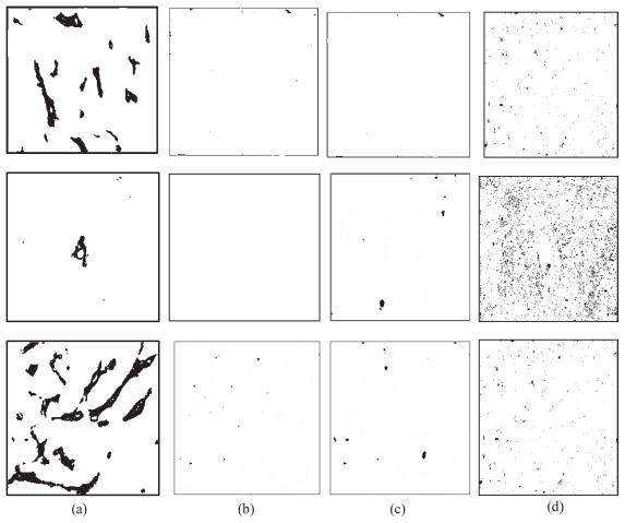Binarization of medical images based on the recursive application of mean shift filtering : Another algorithm.