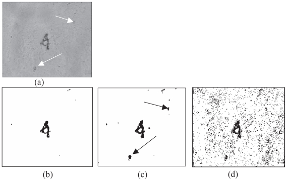 Binarization of medical images based on the recursive application of mean shift filtering : Another algorithm.