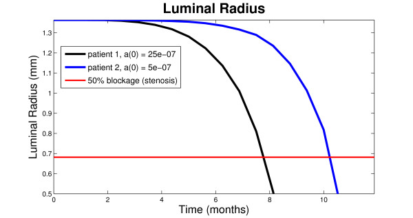 A mathematical model of venous neointimal hyperplasia formation.