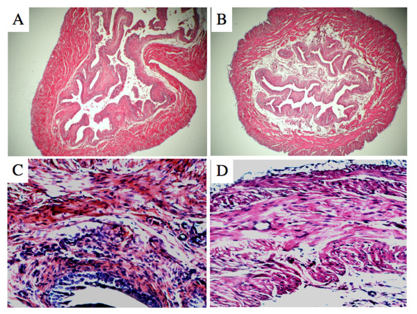 CXCL10 blockade protects mice from cyclophosphamide-induced cystitis.