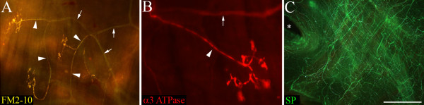 Immunohistochemical characterization of nodose cough receptor neurons projecting to the trachea of guinea pigs.