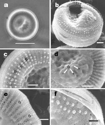 Morphological study of Cyclotella choctawhatcheeana Prasad (Stephanodiscaceae) from a saline Mexican lake.