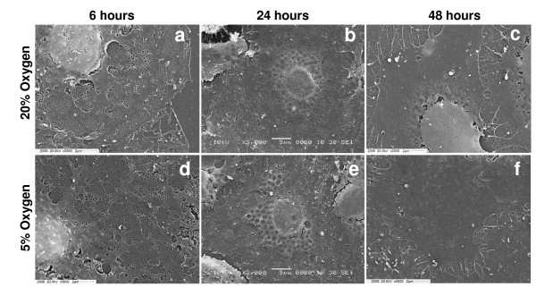 The influence of oxygen tension on the structure and function of isolated liver sinusoidal endothelial cells.