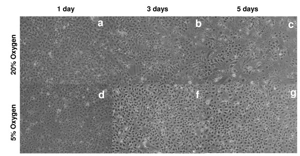 The influence of oxygen tension on the structure and function of isolated liver sinusoidal endothelial cells.