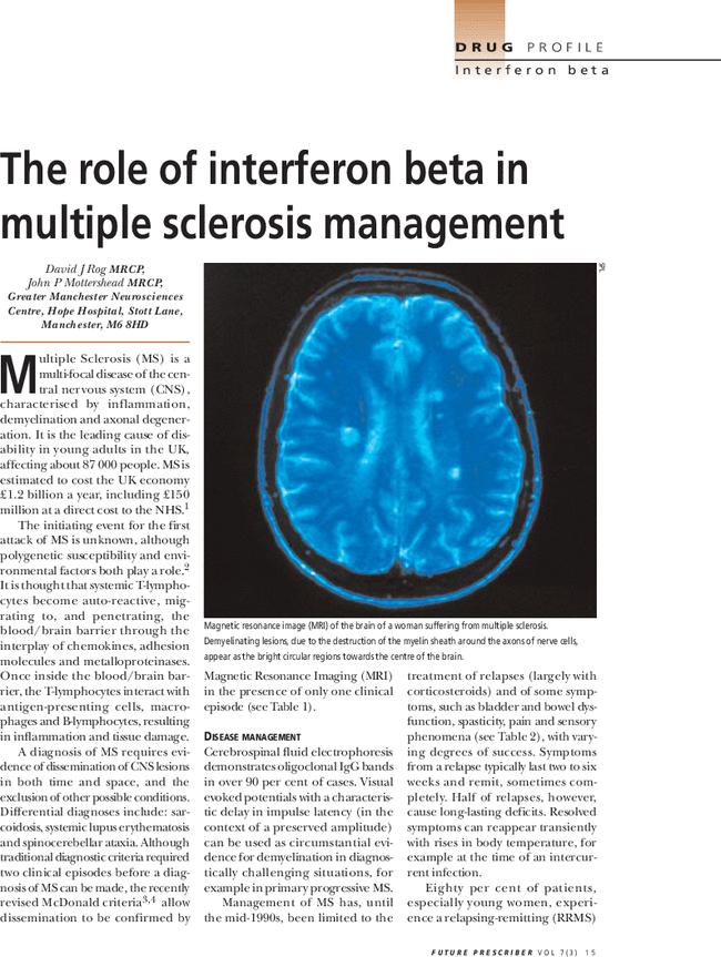 The role of interferon beta in multiple sclerosis management