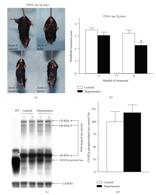 Role of Hypertension in Aggravating Abeta Neuropathology of AD Type and Tau-Mediated Motor Impairment.