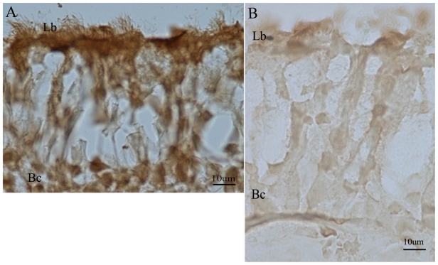 HO1 mRNA and Protein do not Change in Parallel in Bronchial Biopsies of Patients After Long Term Exposure to Sulfur Mustard.