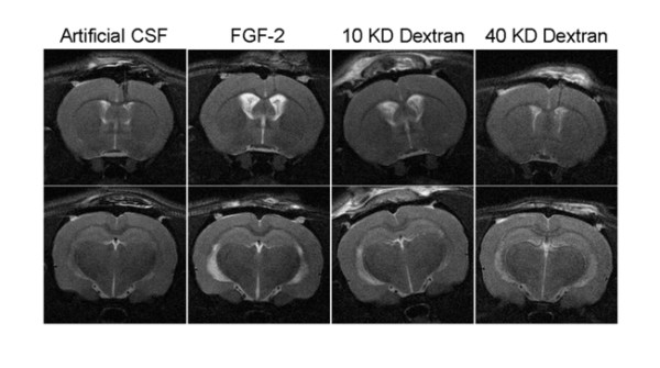 Intraventricular infusion of hyperosmolar dextran induces hydrocephalus: a novel animal model of hydrocephalus.