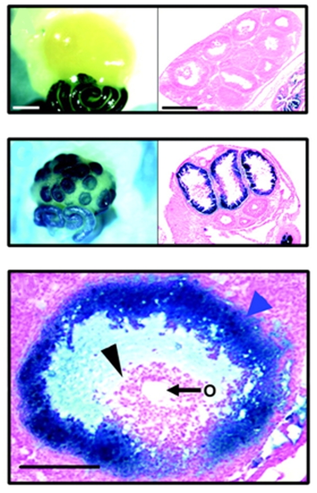 Control of oocyte release by progesterone receptor-regulated gene expression.