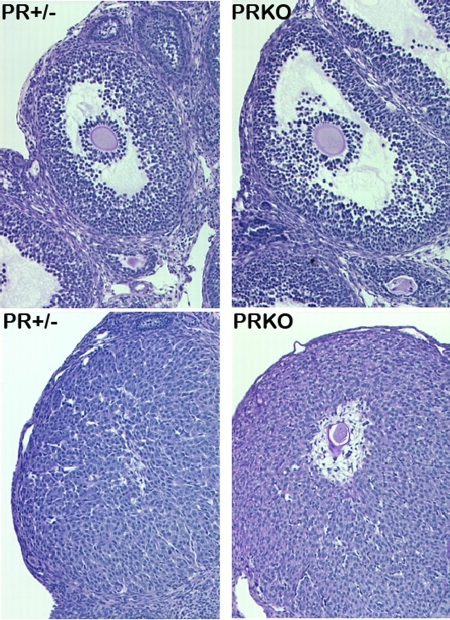 Control of oocyte release by progesterone receptor-regulated gene expression.