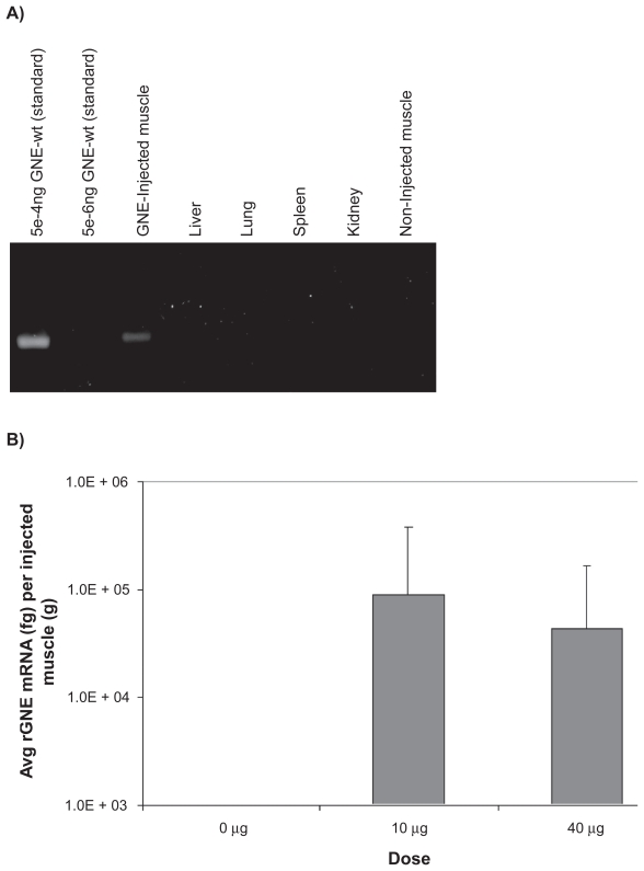 Safety and in vivo expression of a GNE-transgene: a novel treatment approach for hereditary inclusion body myopathy-2.