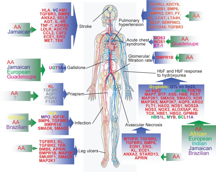 Sickle Cell Disease in the Post Genomic Era: A Monogenic Disease with a Polygenic Phenotype.