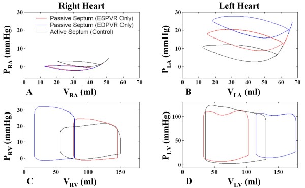 Using a human cardiovascular-respiratory model to characterize cardiac tamponade and pulsus paradoxus.