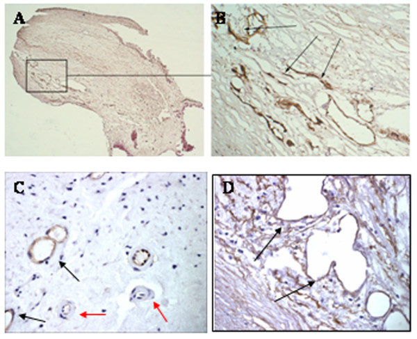 Controlling the angiogenic switch in developing atherosclerotic plaques: possible targets for therapeutic intervention.