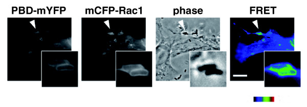 No better time to FRET: shedding light on host pathogen interactions.