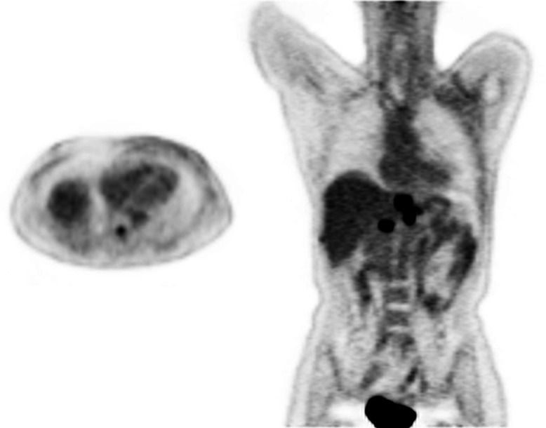 Quantitative imaging of coronary blood flow.