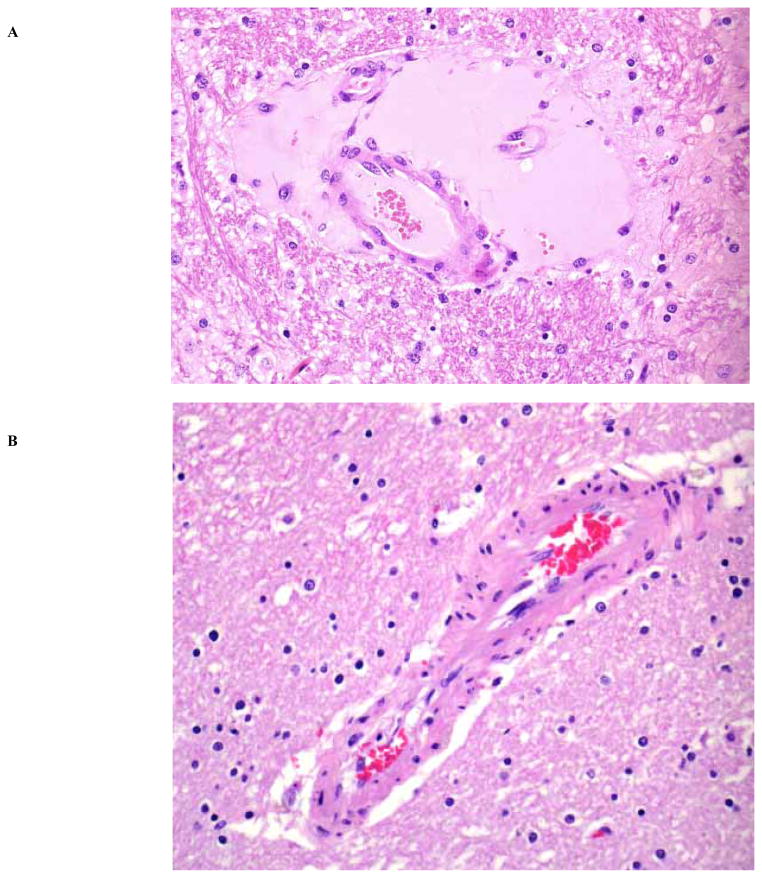 <i>Clostridium Perfringens</i> Toxins Involved in Mammalian Veterinary Diseases.