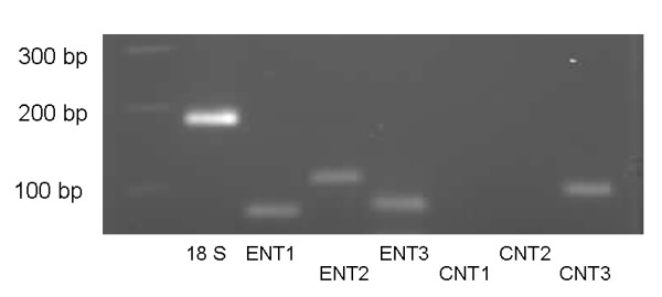 Expression and functional activity of nucleoside transporters in human choroid plexus.