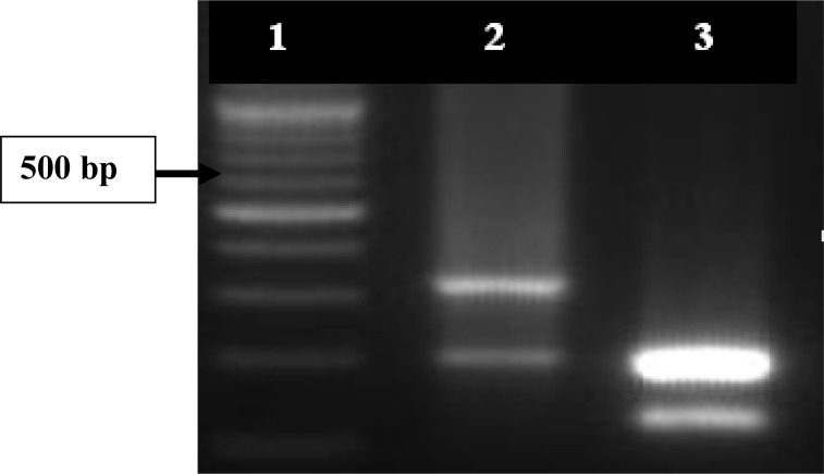 Study on Presence of Borrelia persica in Soft Ticks in Western Iran.