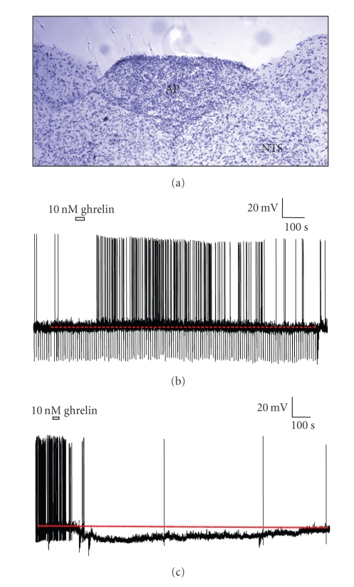 Ghrelin: central nervous system sites of action in regulation of energy balance.