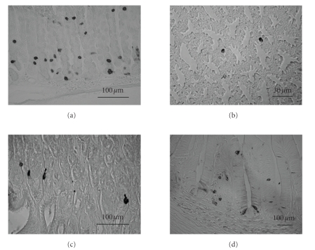 Ghrelin cells in the gastrointestinal tract.