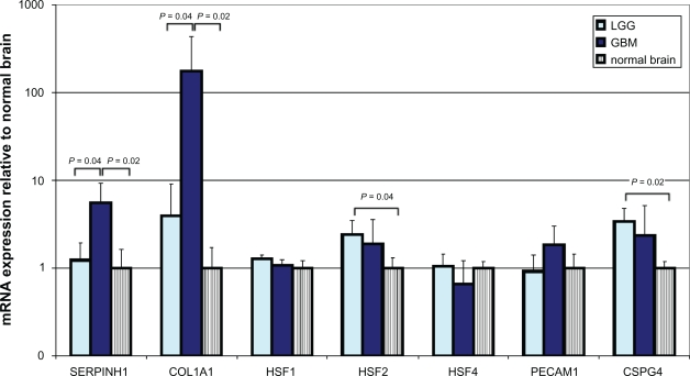 Overexpression of Colligin 2 in Glioma Vasculature is Associated with Overexpression of Heat Shock Factor 2.