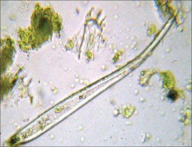 Pharmacognostical and physicochemical evaluation of Agasti leaf.